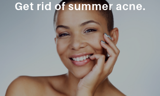 Learn how to get rid of summer acne